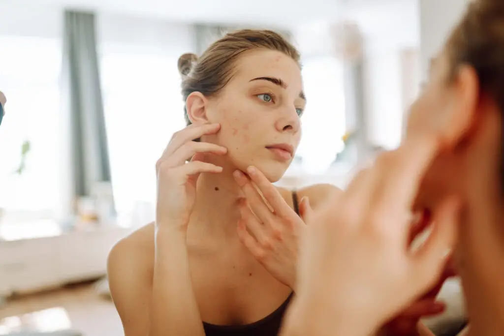 Close-up of a young woman looking at pimples in the mirror.
