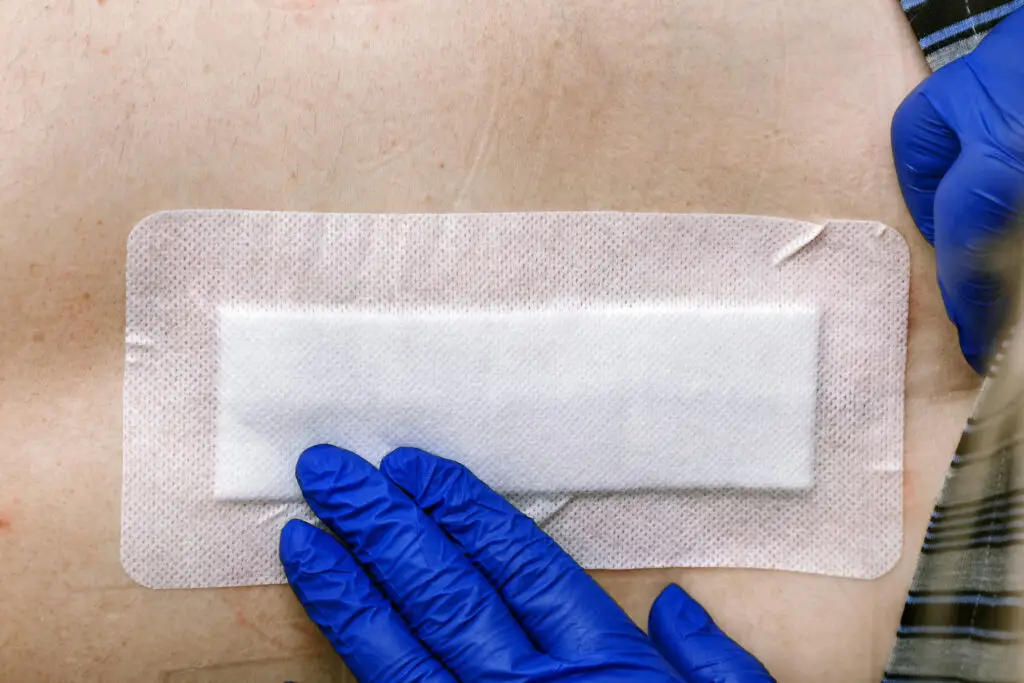 Nurse hand patching mole removal surgery incision as epidermal birthmark concept